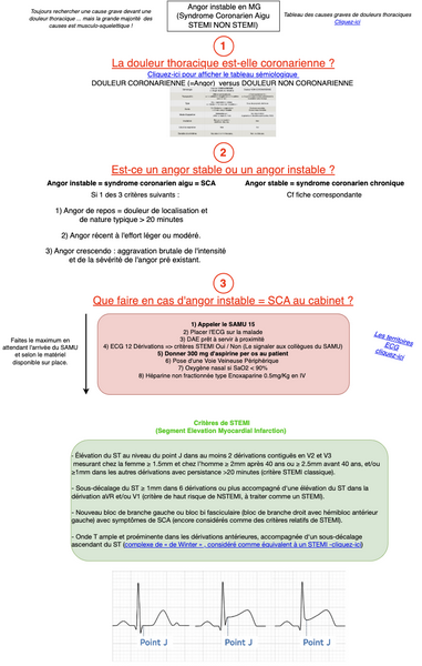 Syndrome coronarien aigu - angor instable en MG (STEMI NON STEMI)