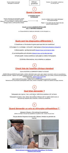 Arthrose : gonarthrose