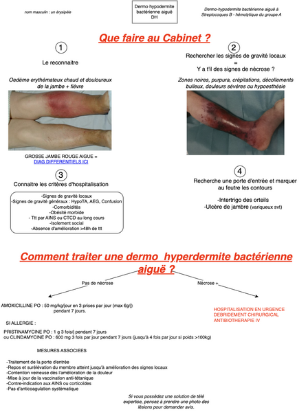 Conduite à tenir en cas d'Érysipèle