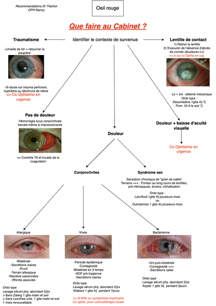 Conjonctivite et oeil rouge 