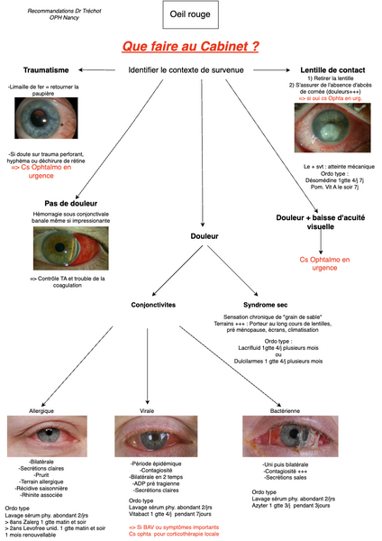 Conduite à tenir en cas d'Œil rouge